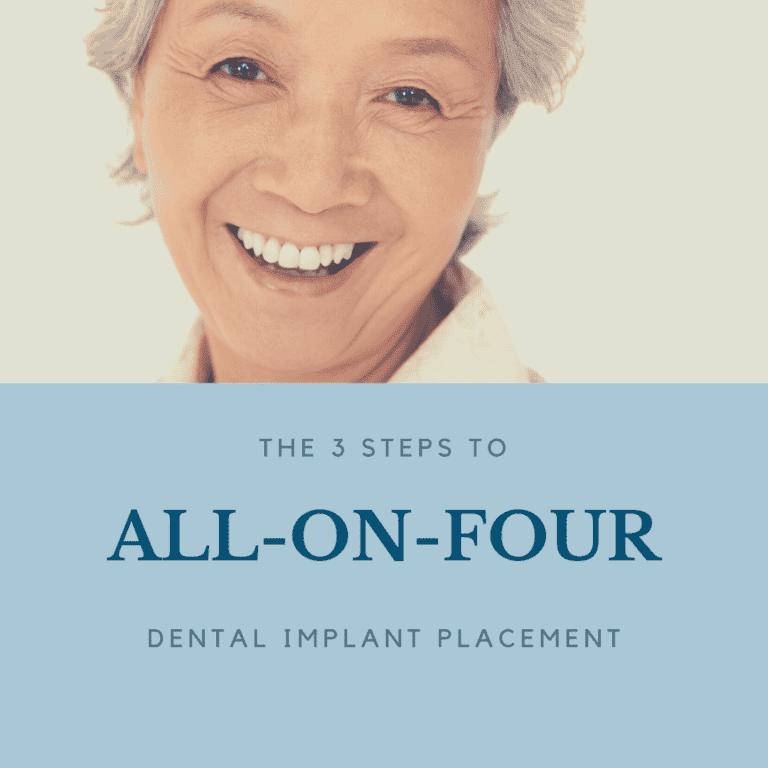 The 3 Steps to all on four implants