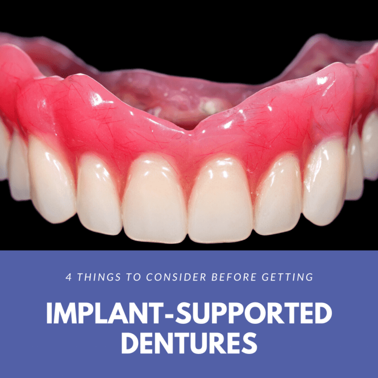4 Things to Consider Before Getting Implant-Supported Dentures (1)