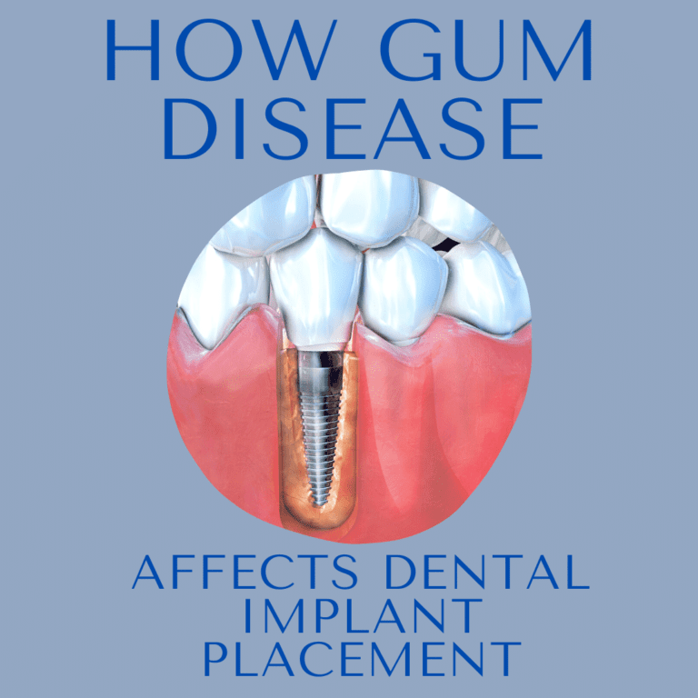 HOW GUM DISEASE AFFECTS DENTAL IMPLANT PLACEMENT