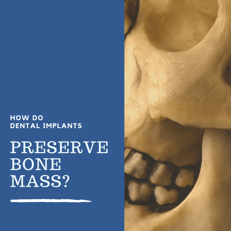 How Do Dental Implants Preserve Bone Mass