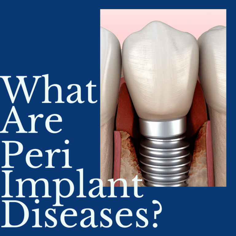 what are peri implant diseases