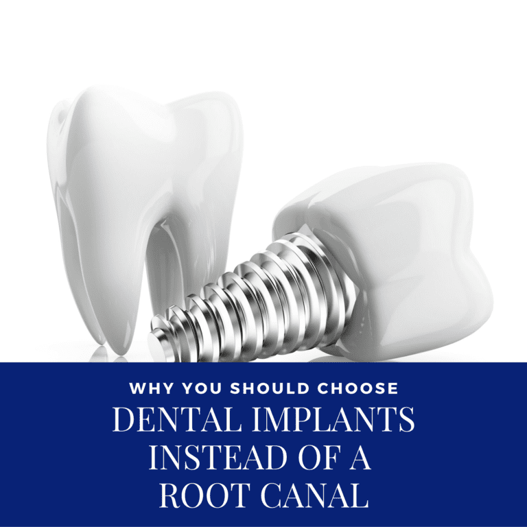Why You Should Choose Dental Implants Instead of a Root Canal