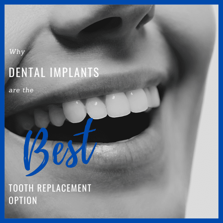 why dental implants are the best tooth replacement option