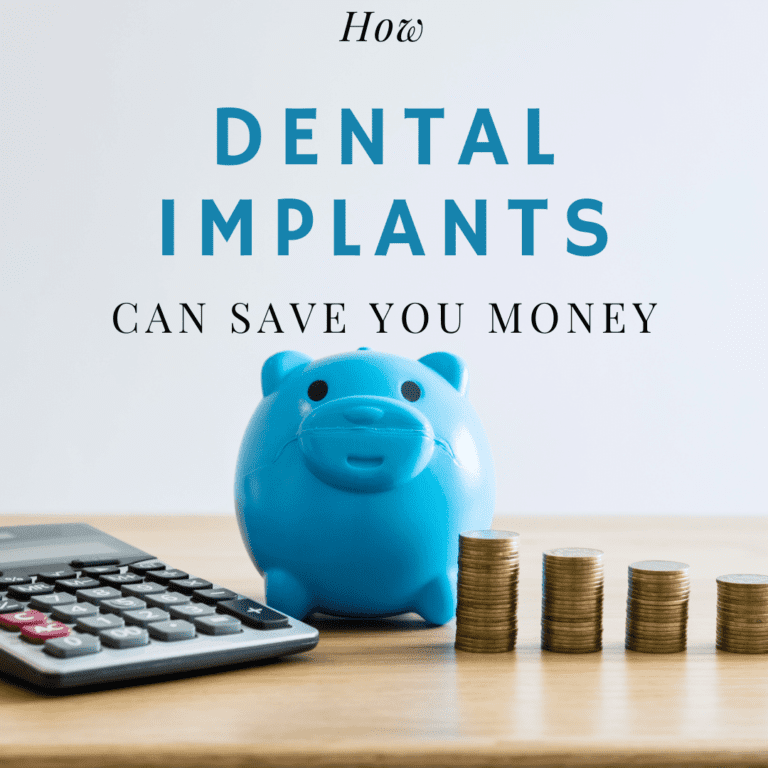 How Dental Implants Can Save You Money