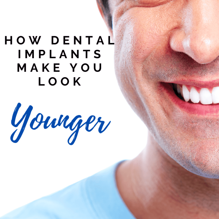 How Dental Implants Make YOu Look younger