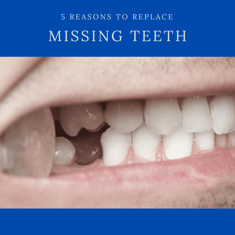 5 Reasons to replace missing teeth