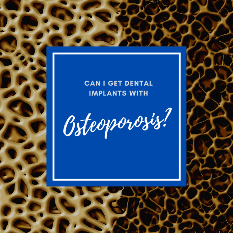 Can I Get Dental Implants with osteoporosis