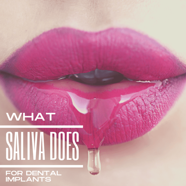 What Saliva Does for dental implants