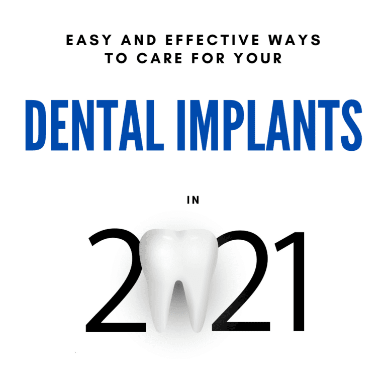 Easy and Effective Ways to care for your dental implants in 2021
