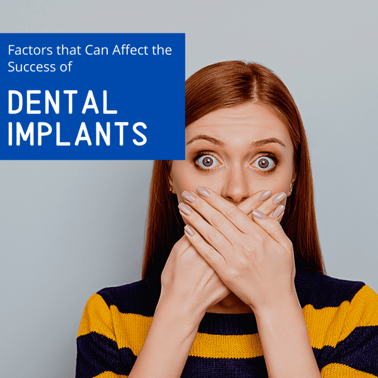 Factors that Can Affect the Success of dental implants