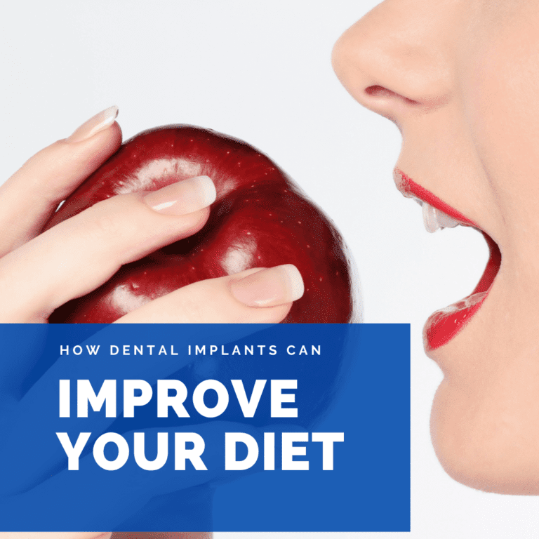How Dental implants Can improve your diet