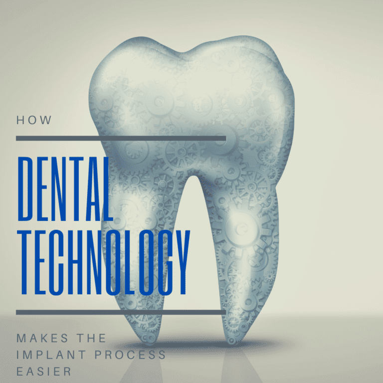 How dental technology makes the implant process easier