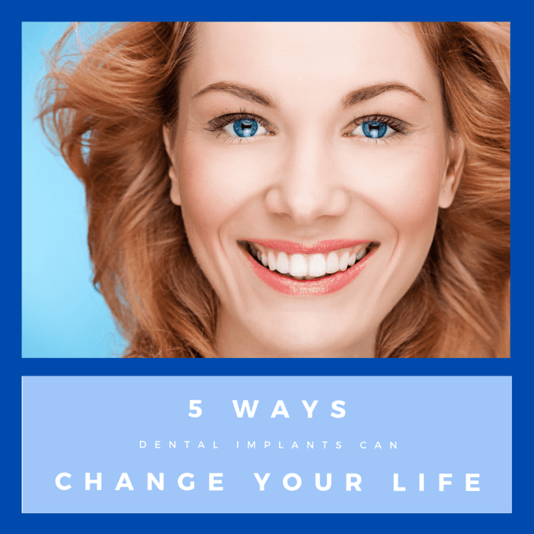 ways dental implants can change your life
