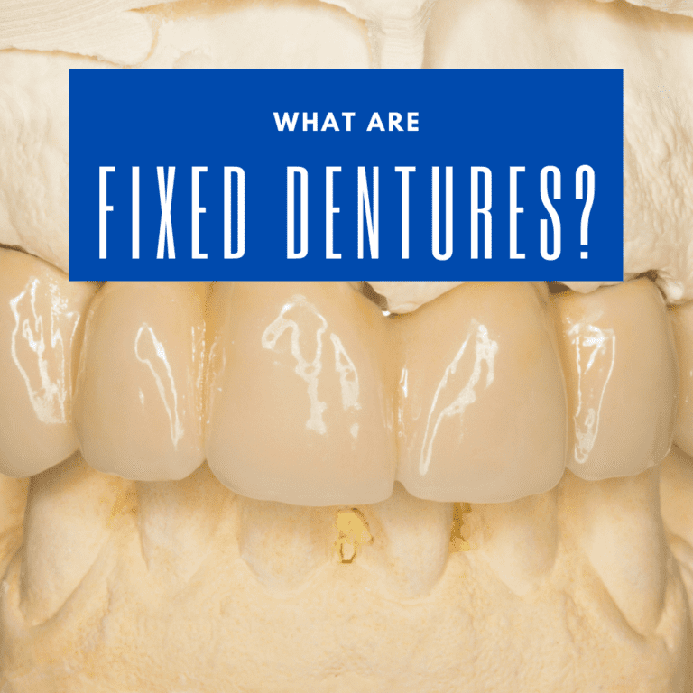 What are Fixed Dentures