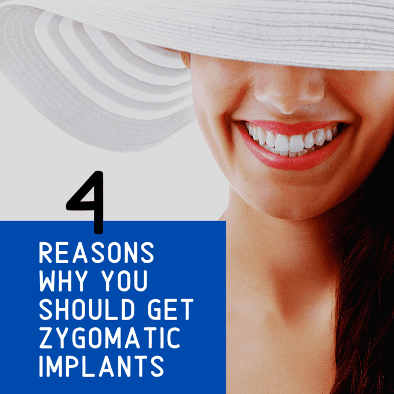 Reasons Why you should Get zygomatic implants