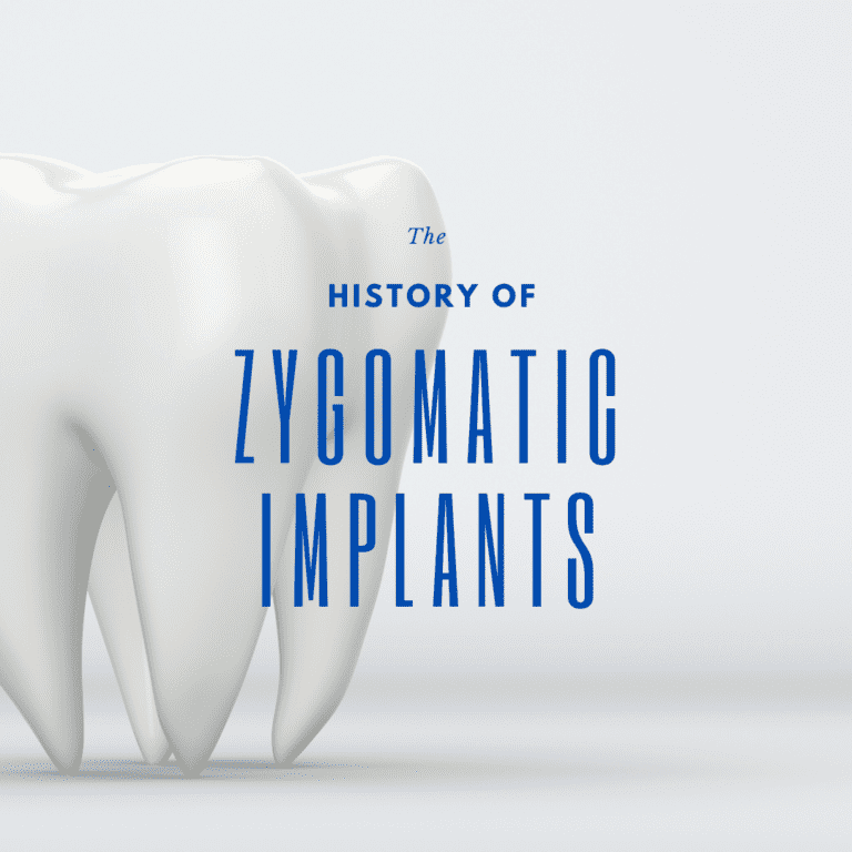 The history of zygomatic implants