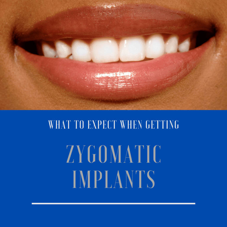 What to Expect When Getting zygomatic implants