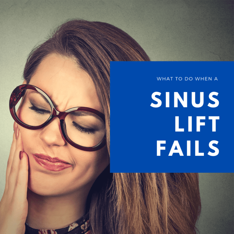 What to do when a sinus lift fails