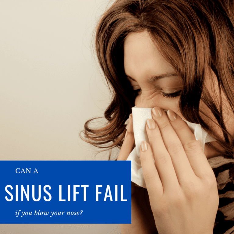 Can A sinus lift fail if you blow your nose