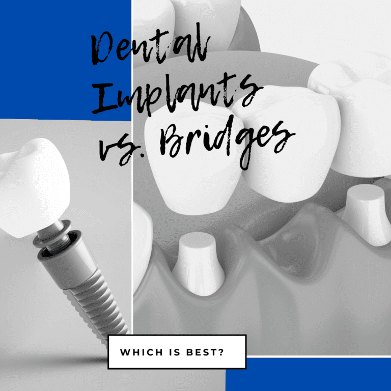 Dental Implants vs. Bridges