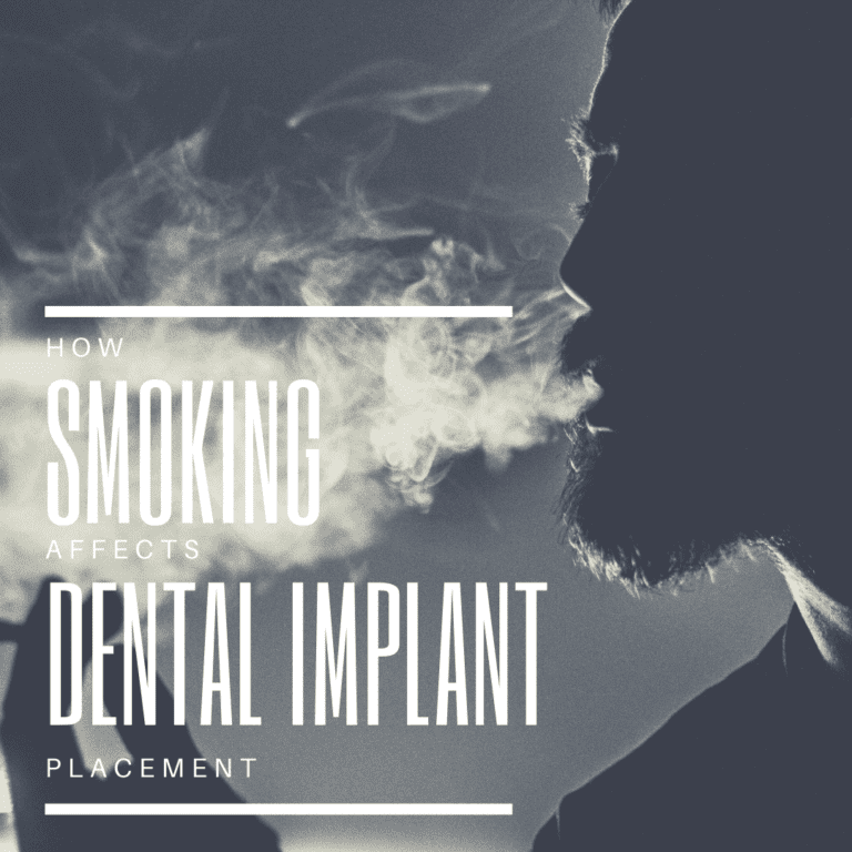 How Smoking Affects Dental implant placement