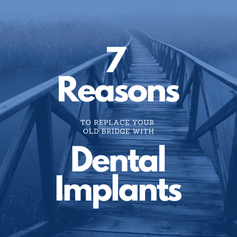 7 Reasons to replace your old bridge with dental implants