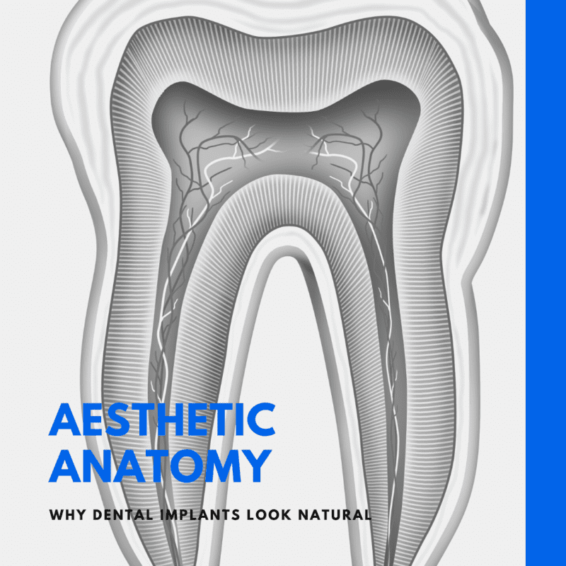 Aesthetic Anatomy: Why Dental Implants Look Natural - Chicago Dental ...