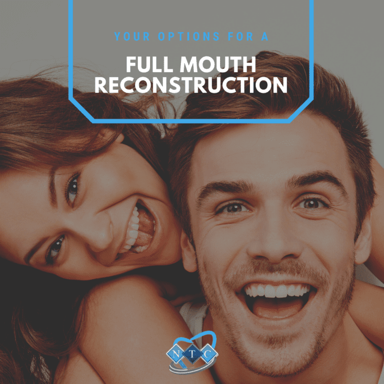 Your Options for a Full Mouth Reconstruction