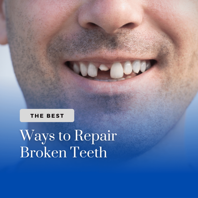 The Best ways to repair broken teeth