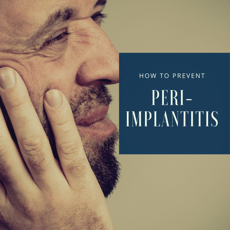 How to Prevent Peri-implantitis