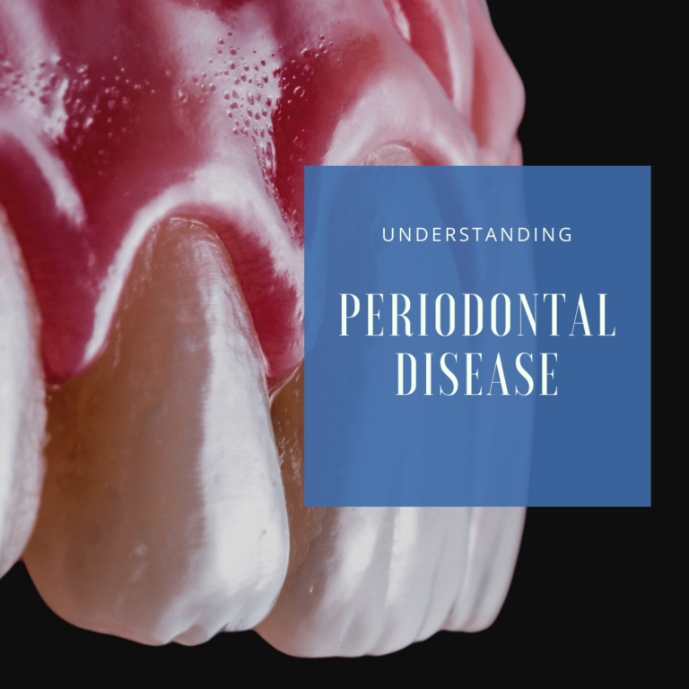 Understanding Periodontal Disease
