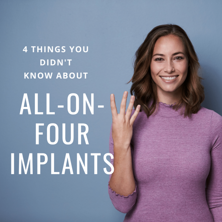 4 Things You Didn't Know About All On Four Implants
