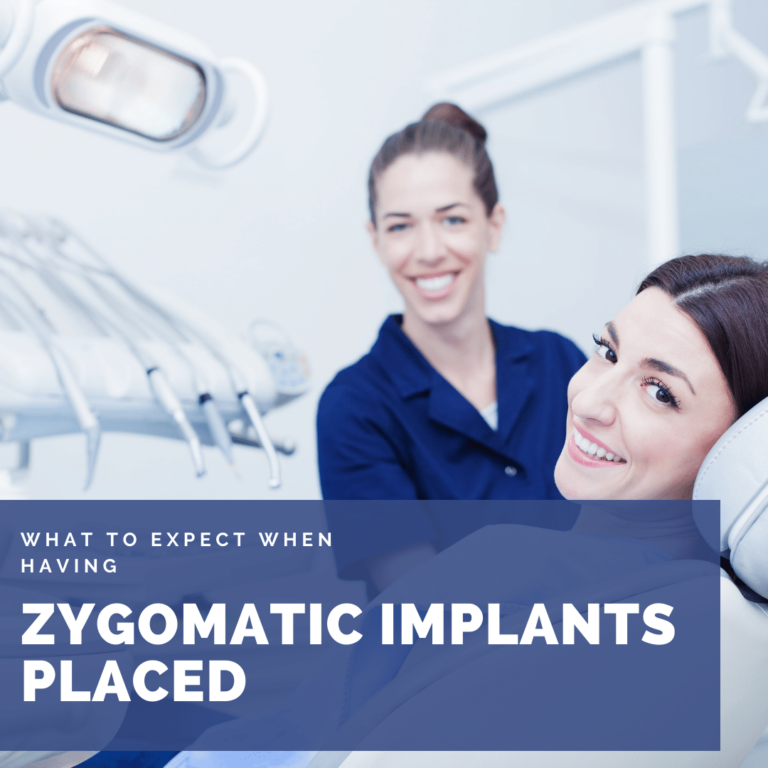 What to Expect when having zygomatic implants placed
