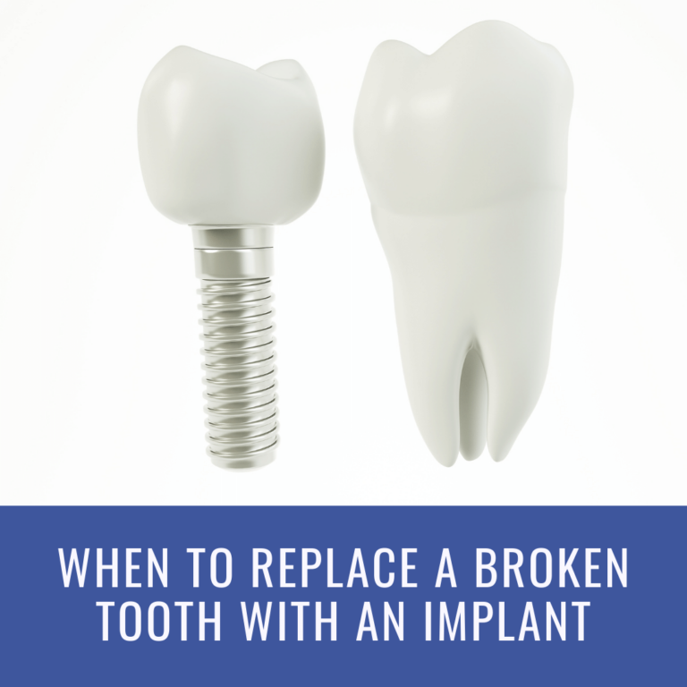 When to Replace a Broken Tooth