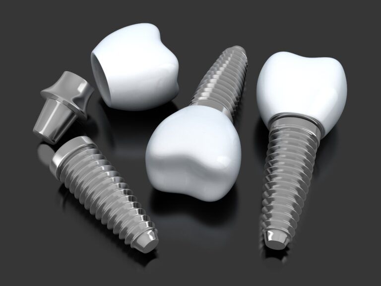 dental implants scattered on a black background