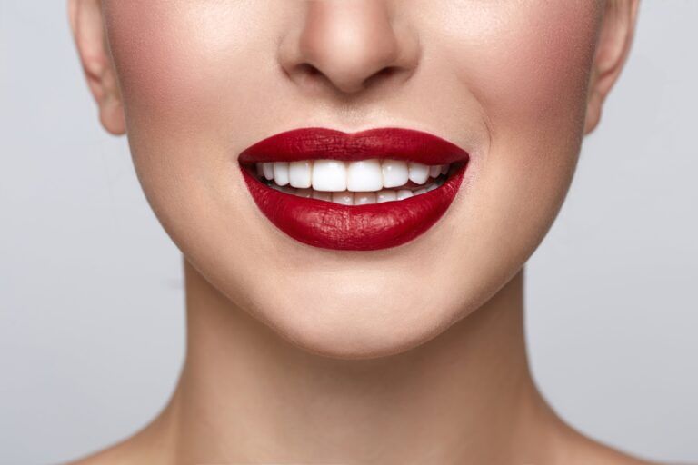 woman with red lips and white porcelain veneer smile
