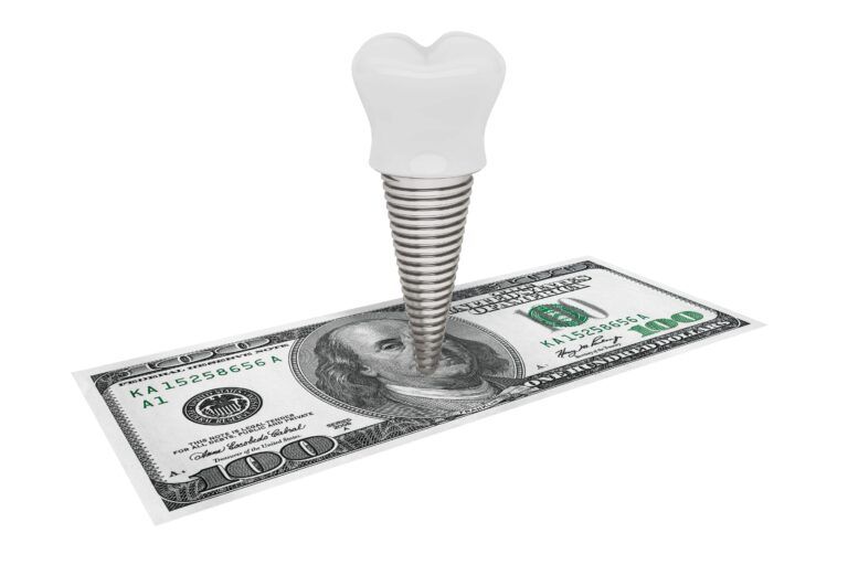 dental implant on a $100 bill