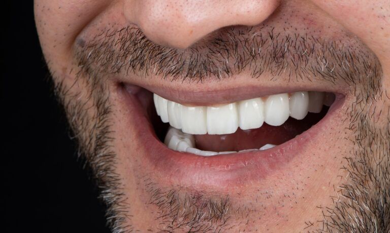 lower half of man's face smiling